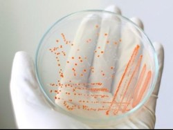 Aromaterapi Jadi Pemicu Wabah Langka di AS, Pasien Mual-Sesak Napas