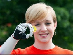 Tangan Bionik Paling Mirip dengan Aslinya Dipakai Pertama Kali oleh Nicky