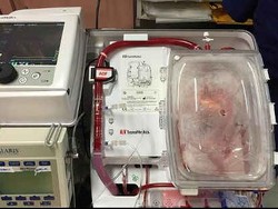Transplantasi Organ, Objek Wisata Medis Utama di Puerto Rico