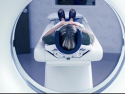 Ini Terapi Trombolisis RSPON yang Bisa Tangani Stroke dengan Cepat