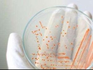 6 Benda Tak Terduga yang Bisa Jadi Sarang Kuman dan Bakteri