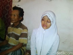 Akibat Kanker Otak, Mata Gadis Pasuruan ini Bengkak