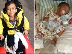 Bocah Ini Akhirnya Bisa ke Toilet Berkat Suntik Botox