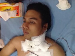 Belajar dari Kisah Almarhum Robby yang Merokok Sejak Kelas 6 SD