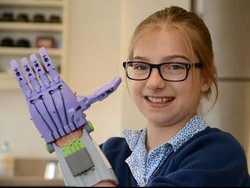 Lahir dengan Satu Tangan, Lara Dibuatkan Tangan Prostetik oleh Teman-temannya