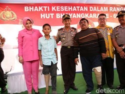 HUT Bhayangkara, Kapolda Metro Sumbang Kaki Palsu ke Korban Kecelakaan