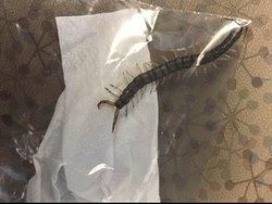 Bangun-bangun Kesakitan, Remaja Ini Keluarkan Kelabang dari Telinga