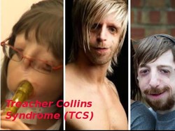 Dokter: Banyak Memicu Gangguan, Kelainan Struktur Wajah Bisa Dikoreksi