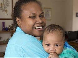 Kisah Fitz, Bayi yang Terlahir dengan Tumor Sebesar Bola Bisbol di Bokong