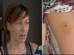 Wanita Ini Kena Tembak, Baru Sadar 5 Hari Kemudian