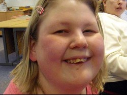 Selalu Lapar, Wanita Ini Tak Berhenti Makan Sampai Meninggal