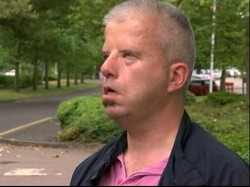 Idap Kelumpuhan Wajah, Alex Disangka Mabuk dan Tak Dilayani di Bar