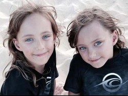 Kisah Ibu Asal Australia dengan Bayi Kembar yang Tali Pusarnya Berkaitan