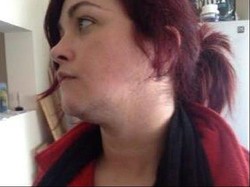 Hormonnya Terganggu, Wanita Ini Harus Cukur Jenggot Tiga Kali Sehari