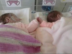 Berjuang Hidup, Kembar Prematur Ini Bergandengan Tangan di Inkubator