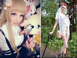 Idap Distrofi Otot, Wanita Ini Jadi Boneka Barbie Hidup di Dunia Nyata