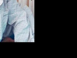 Digigit Nyamuk, Wajah Pria Ini Membengkak Sebesar Balon