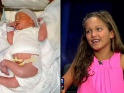 Salut, Addie Galang Dana untuk RS yang Merawatnya Saat Lahir