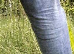 Pria Susah Buang Air Kecil, Waspada Pembesaran Prostat