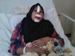 Wanita Muda Ini Luka Parah Gara-gara Dijambret di Jembatan Pasupati