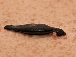 Ternyata Ini Penyebab Banyak Lintah Bermunculan di Rumah?