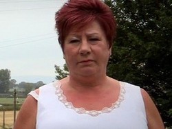 Jalani Operasi Payudara, Wanita Ini Kehilangan Puting dan Alami Infeksi