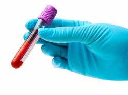 Tentang Rapid Test Corona yang akan Datang dari China Hari Ini