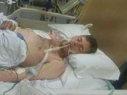 Lolos dari Kematian, Pria Inggris Unggah Foto Dirinya Saat Koma