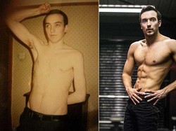 Sempat Kurus karena Crohns Disease, Kini Ralph Bugar dan Bertubuh Kekar