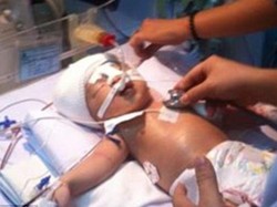 Panik Saat Beraksi, Pencuri Tikam Kepala Bayi di Rumah Sakit