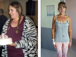 Diet Ekstrem dan Asup 100 Kalori Sehari, Kini Victoria Lawan Anoreksia