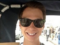 Jake Hampir Keracunan Hidrogen Peroksida Gara-gara Pakai Pemutih Gigi