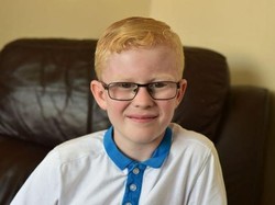 Alergi Langka, Sinar Matahari Bisa Bikin Kulit Bocah Ini Terbakar