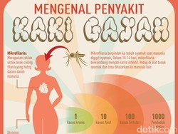 4 Hal yang Wajib Diketahui Soal Penyakit Kaki Gajah