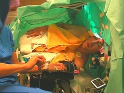 Tanpa Dibius, Pria Ini Jalani Operasi Otak Sambil Bernyanyi Tenor