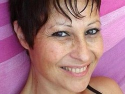 Sang Kakak Jadi Donor, Wanita Ini Jalani Transplantasi Ginjal Lewat Vagina