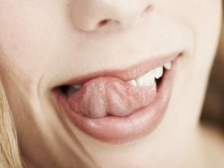 Aneka Masalah Mulut yang Kerap Dikeluhkan Saat Puasa dan Cara Mengatasinya