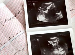 Kulit Leher Menghitam Tanda Ibu Hamil Anak Laki-laki?