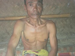 Tolong Bapak Mista, Warga Bekasi ini Sakit Bertahun-tahun Butuh Bantuan