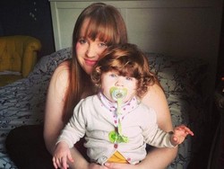 Bocah Ini Punya Rambut Lebat, Tak Tahunya Gejala Penyakit Langka