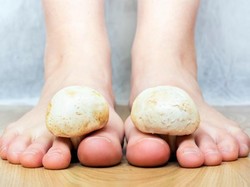 Kuku Jari Hitam dan Rusak Seperti Mati, Apa Penyebabnya?