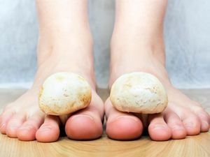 Cara Aman Atasi Berbagai Kondisi Kuku Kaki, Lepas Maupun Berdarah Cara Aman Atasi Berbagai Kondisi Kuku Kaki, Lepas Maupun Berdarah