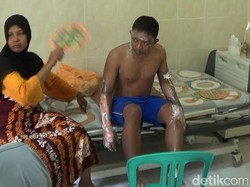 Depo Perbaikan Elpiji Meledak, 8 Pekerja Terluka Bakar