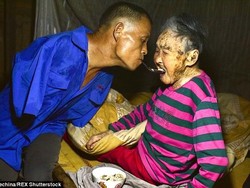 Tak Punya Tangan, Pria Ini Tetap Semangat Mengurus Ibunya yang Lumpuh