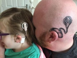 Tingkatkan Percaya Diri Sang Putri, Ayah Ini Pasang Tato Implan Koklea