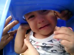 Kepala Bocah Tersangkut Kursi Plastik, Pemadam Kebakaran pun Dipanggil