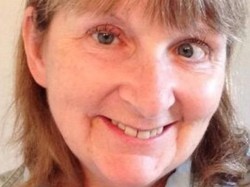 Digigit Lalat, Wanita ini Kehilangan Sebelah Payudaranya