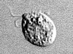 Picu Pria Tewas usai Berenang, Sefatal Ini Infeksi Amoeba Pemakan Otak