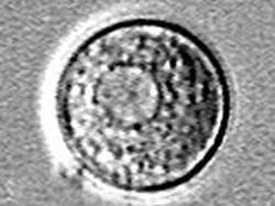 Bayi 16 Bulan Tewas Kena Amoeba Pemakan Otak, Awalnya gegara Main Air