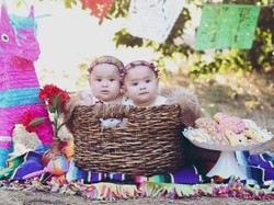 Mengharukan! Bayi Kembar yang Tuli Ini Kini Bisa Dengar Suara Ayah Ibunya